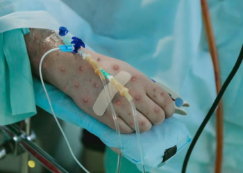 Cofepris avanza en la vacuna contra el Mpox