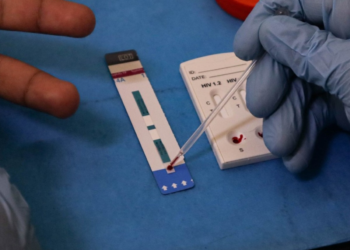 Disminuye mortalidad por VIH en México