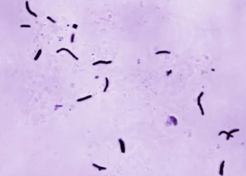Brote de tuberculosis aterroriza Kansas City