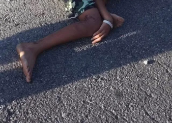 Tragedia en Progreso: menor es atropellado y pierde la vida tras ser proyectado por los aires