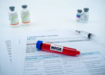 Incrementan los casos de Mpox en Yucatán y refuerzan la vigilancia sanitaria