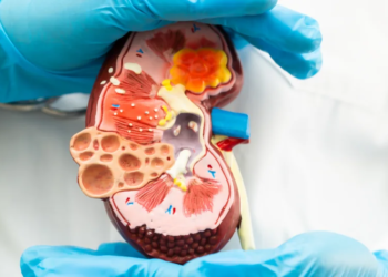 Científicos logran el primer trasplante de riñón humano convertido al tipo de sangre universal